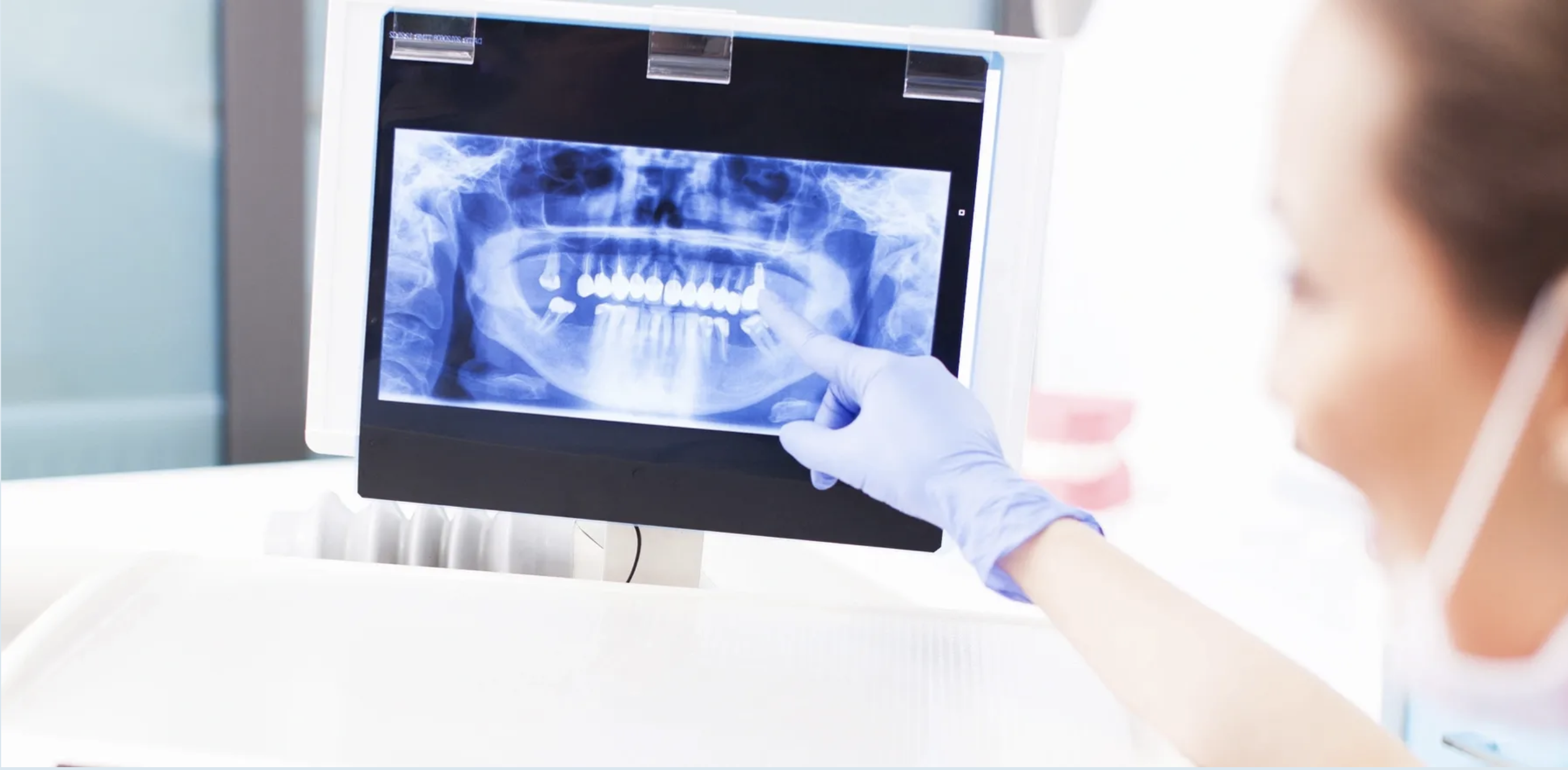 A woman points at a mouth xray.