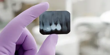 tiny dental xray